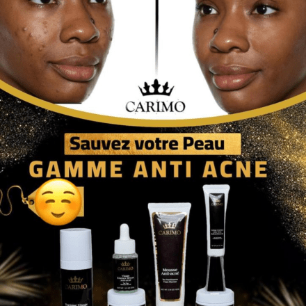 Dites Adieu à l’acné : La routine minimaliste en 3 produits qui transforme votre peau