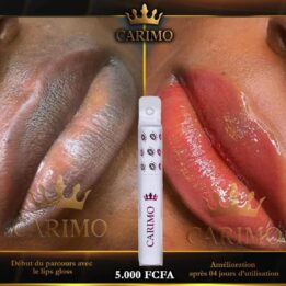 Stick a Lèvres Hydratant CARIMO – Lèvres Douces, Nourries & Protégées