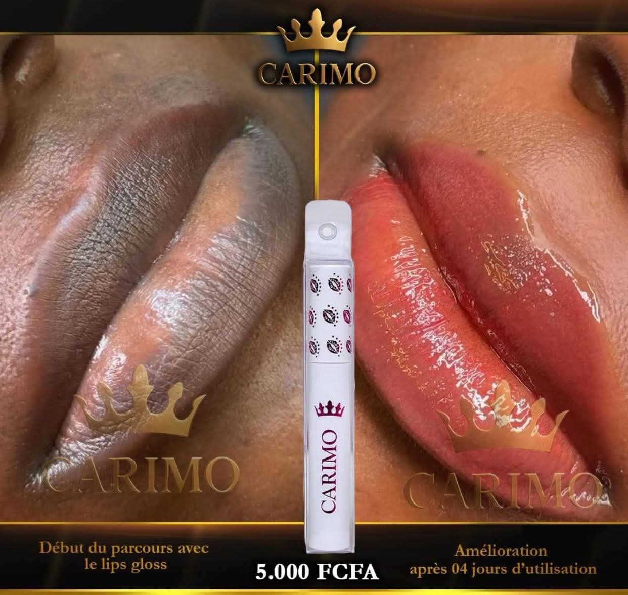 Stick a Lèvres Hydratant CARIMO – Lèvres Douces, Nourries & Protégées